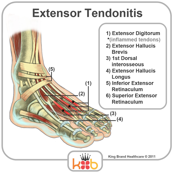 List 101+ Images Types Of Foot Pain With Pictures Updated