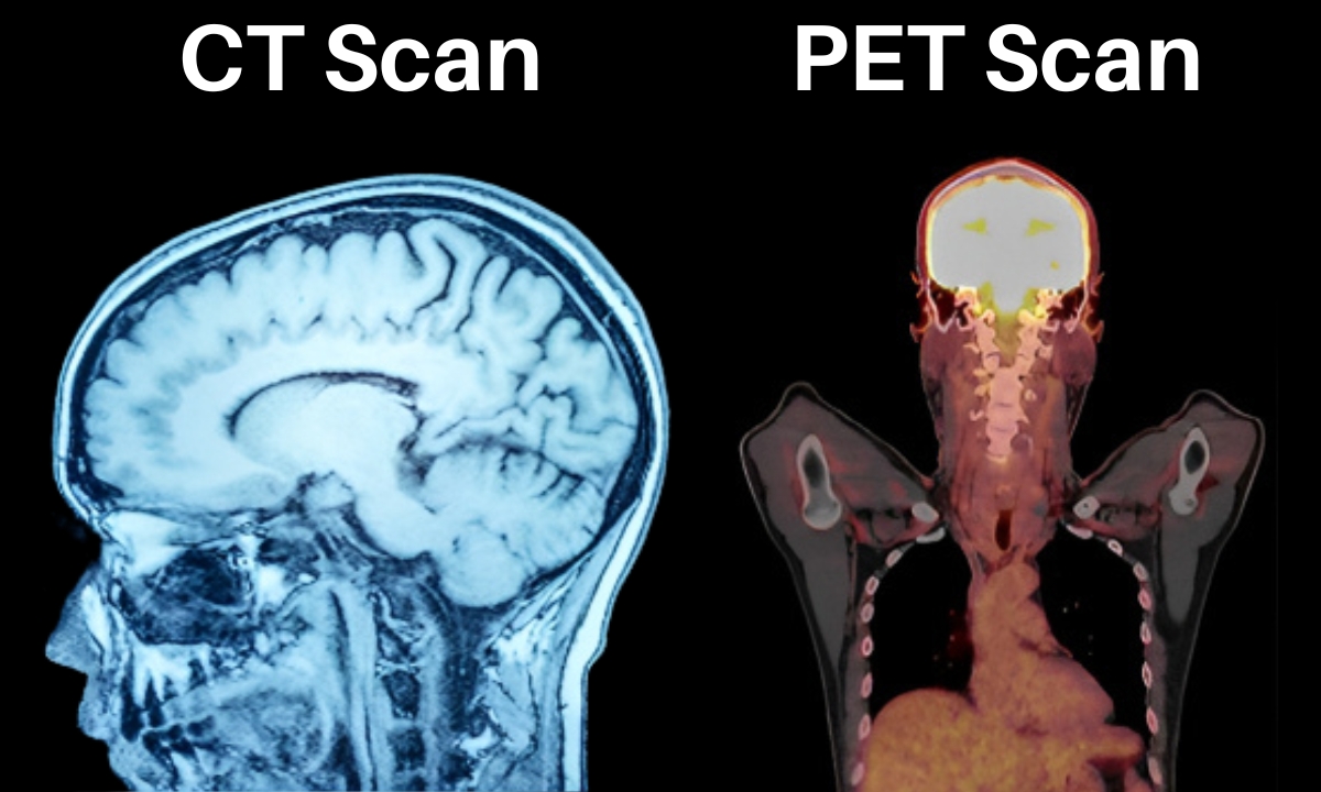 PET Scan VS CT Scan