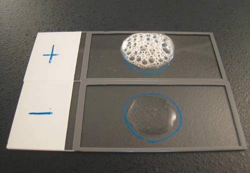 Slide method for catalase test image photo picture