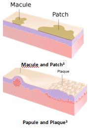 Approach to Skin Lesions | Learn Pediatrics