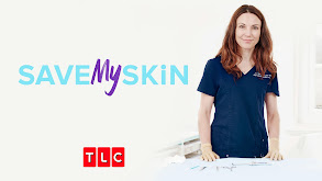 Save My Skin thumbnail