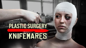 Plastic Surgery Knifemares thumbnail