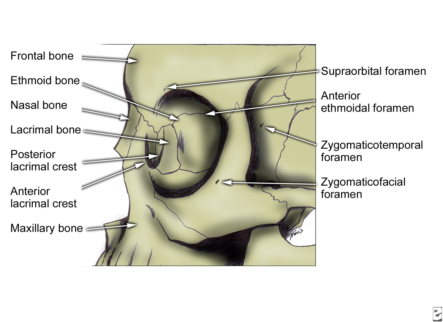 Zygoma, lateral view.