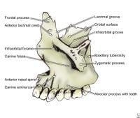 Left maxilla.