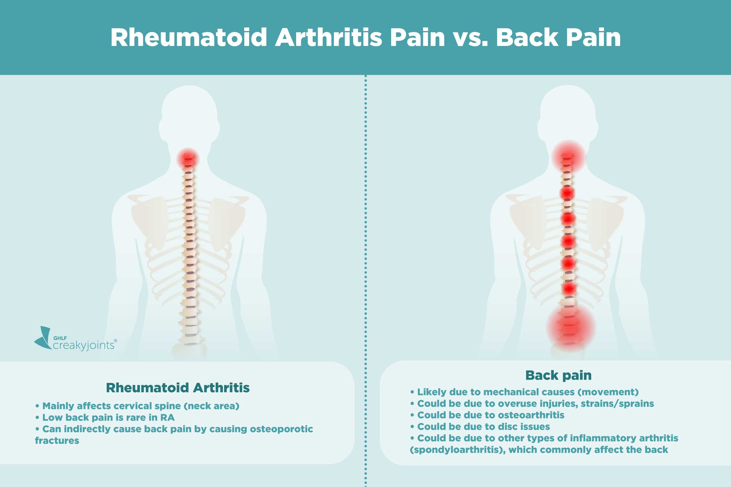 Causes Of Rheumatoid Arthritis Pain Aside From Inflammation