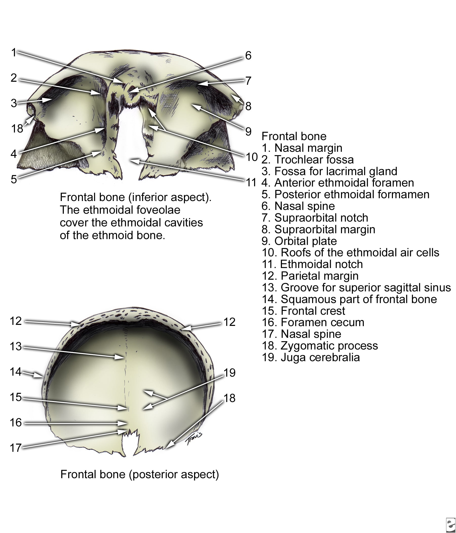 Frontal bone, inferior and  posterior aspects.