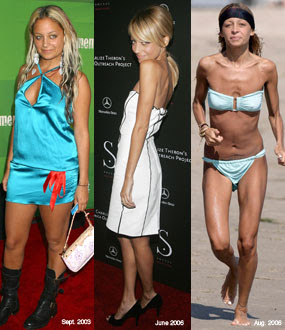 nicole richie before and after weight loss