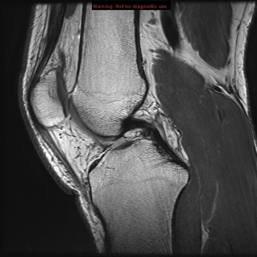 Stanford Msk Mri Atlas 2020