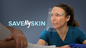 Save My Skin thumbnail