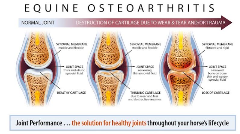 Osteoarthritis