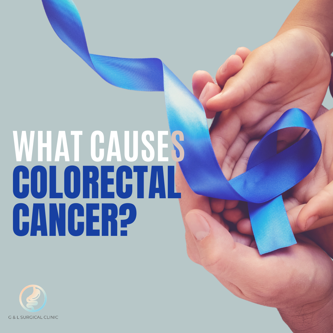 What Causes Colorectal Cancer - Bariatric Clinic Singapore