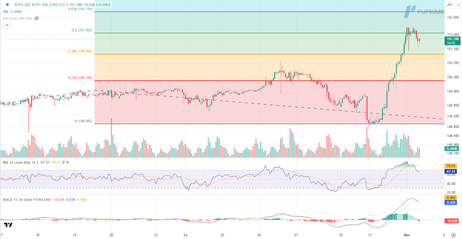 USD/JPY price chart 1 November 2023