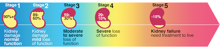 Stages Of Kidney Disease Gfr