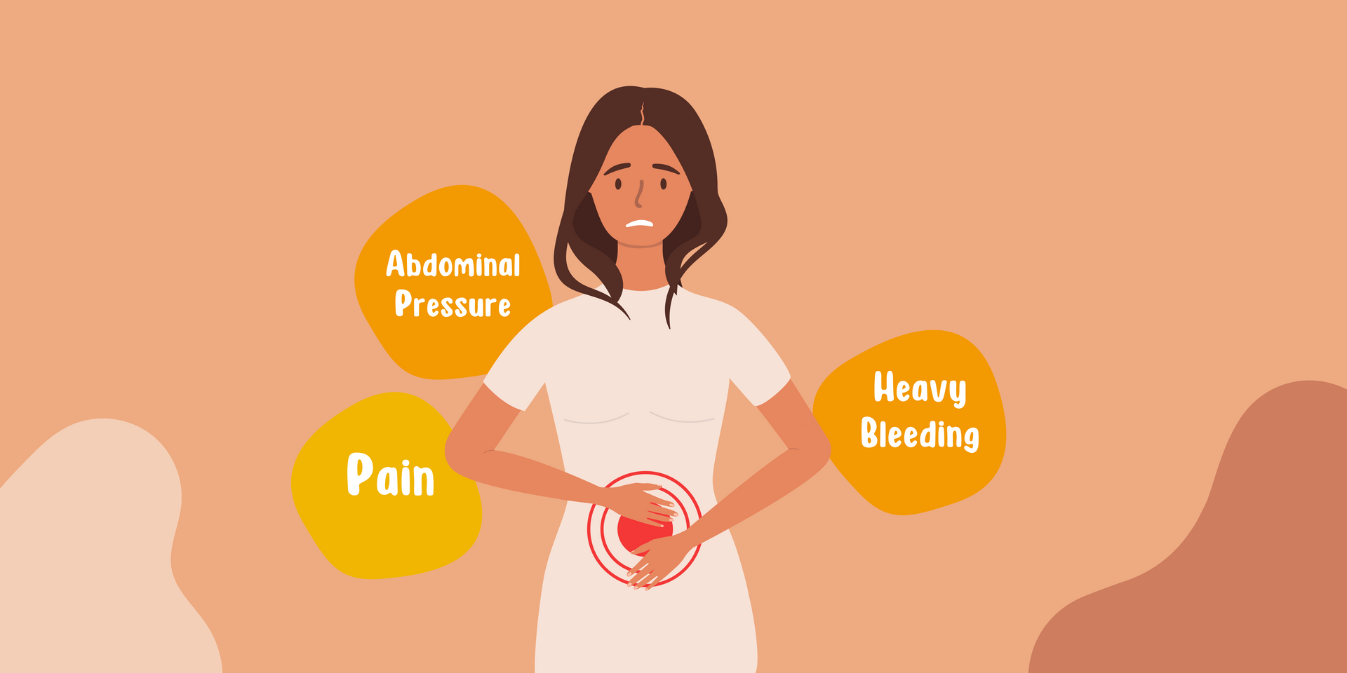 Uterine Fibroids