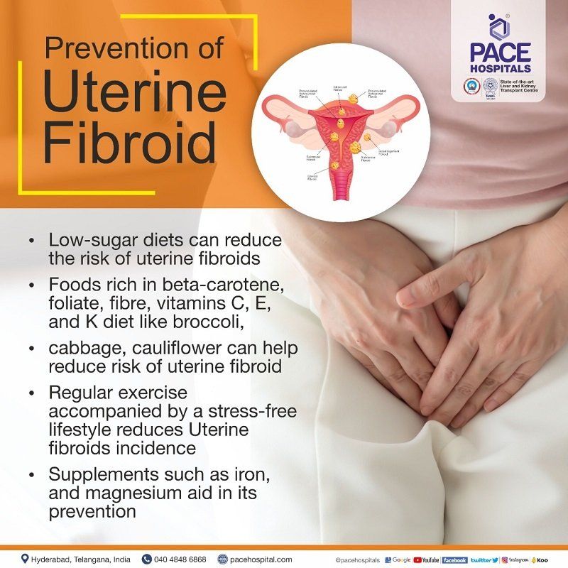 Uterine Fibroids - Symptoms, Causes, Complications and Prevention