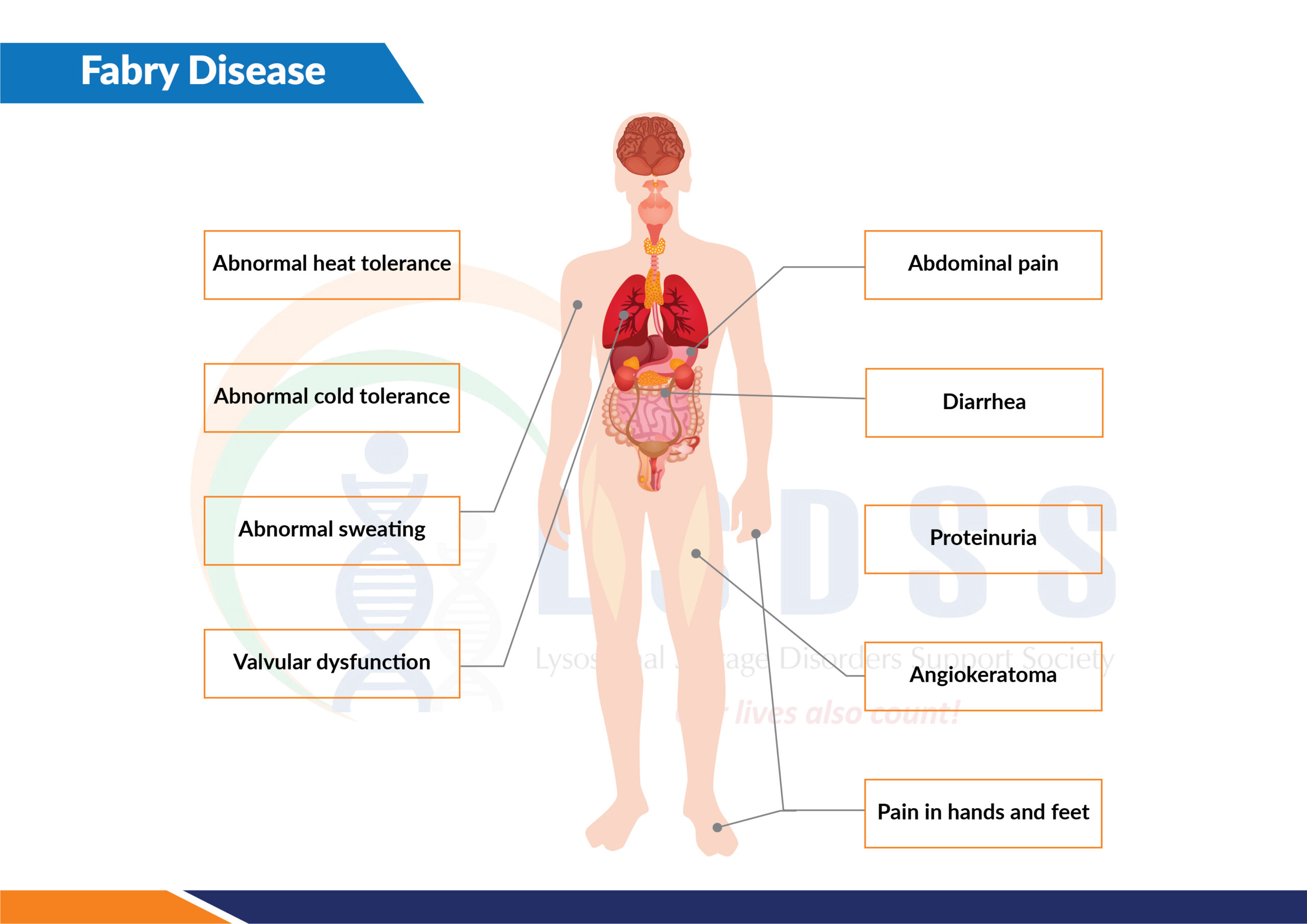 Fabry Disease