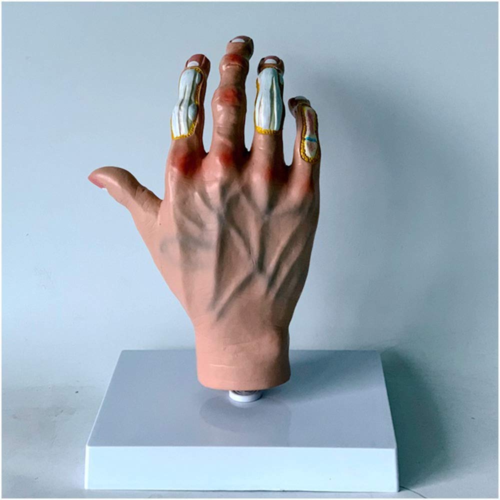 Buy Palm Anatomy Models - Anatomical Structure of the Painful Wind ...