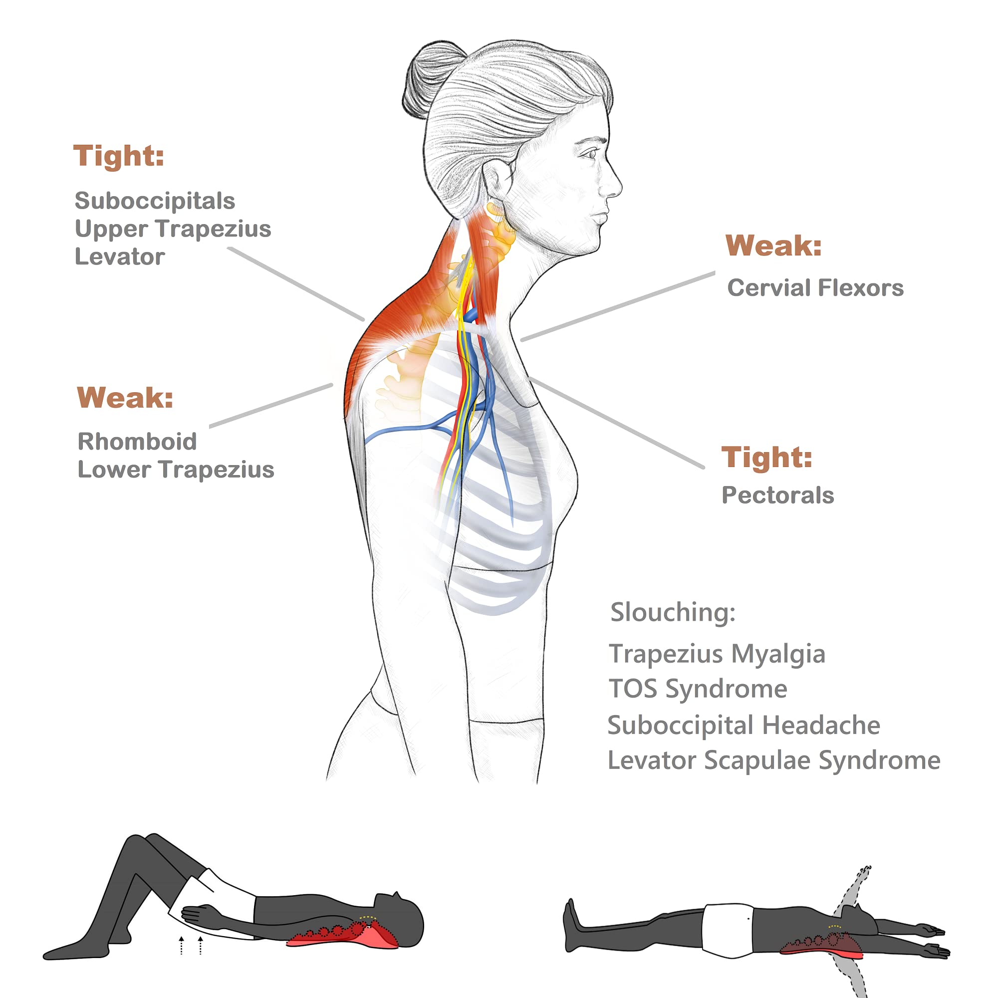 Trapezius Stretches