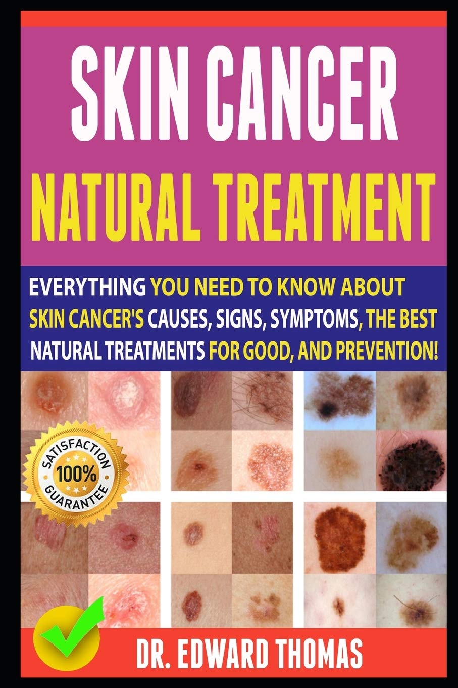 Buy Skin Cancer Natural : Everything You Need To Know About Skin Cancer ...