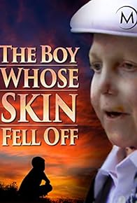 Primary photo for The Boy Whose Skin Fell Off