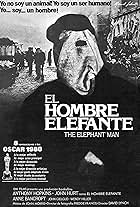 El hombre elefante