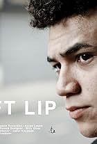 Cleft Lip