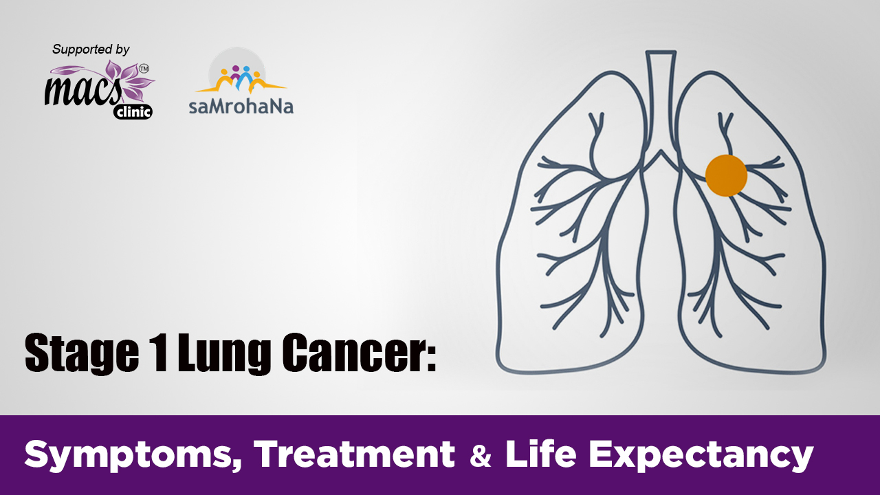 Stage 1 Of Lung Cancer