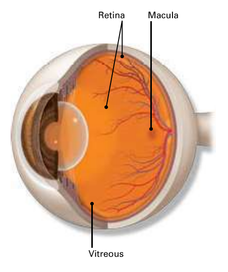 Vitreomacular Traction - Macula Retina Vitreous Center