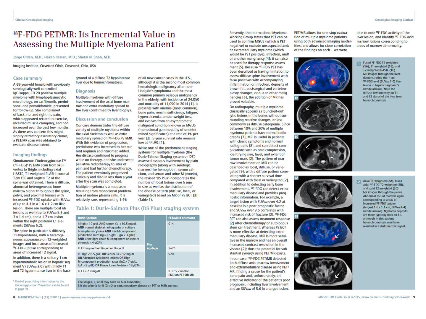 Siemens - MRI - MAGNETOM World - Hot Topics - Quantitative Whole-Body MRI - 18F-FDG PET/MR: Its Incremental Value in Assessing the Multiple Myeloma Patient - Shah