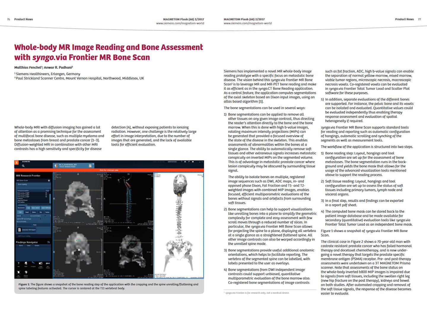 Siemens - MRI - MAGNETOM World - Hot Topics - Quantitative Whole-Body MRI - Whole-body MR Image Reading and Bone Assessment with syngo.via Frontier MR Bone Scan - Fenchel