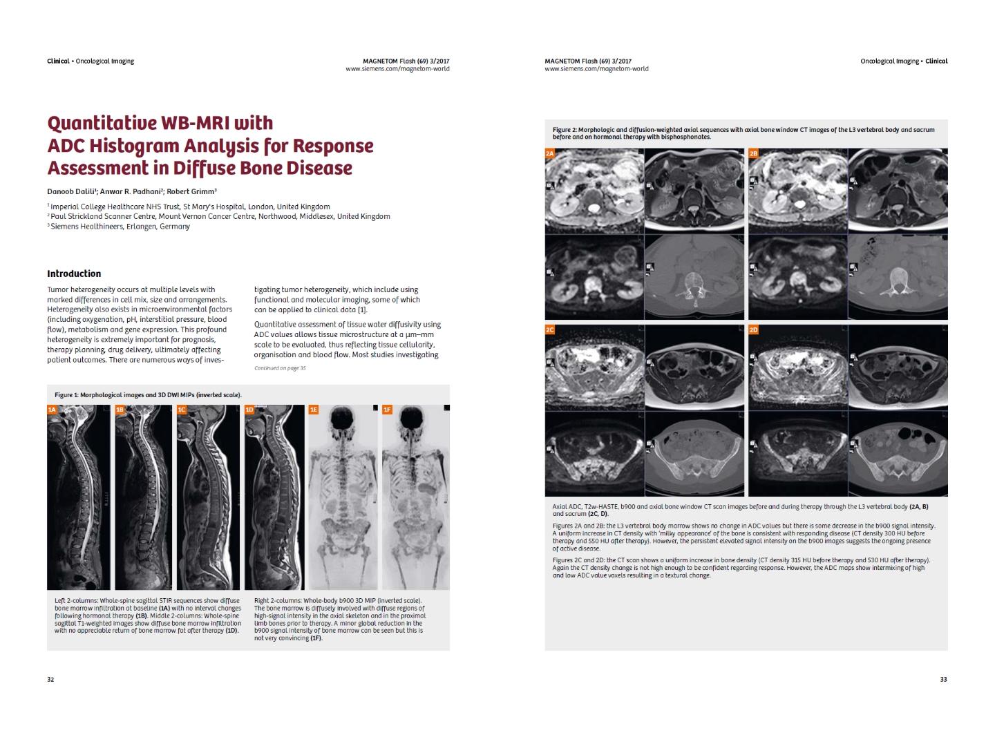 magnetom-flash-69_quantitative-wb-mri-with-adc-histogram-analysis_dalili.jpg