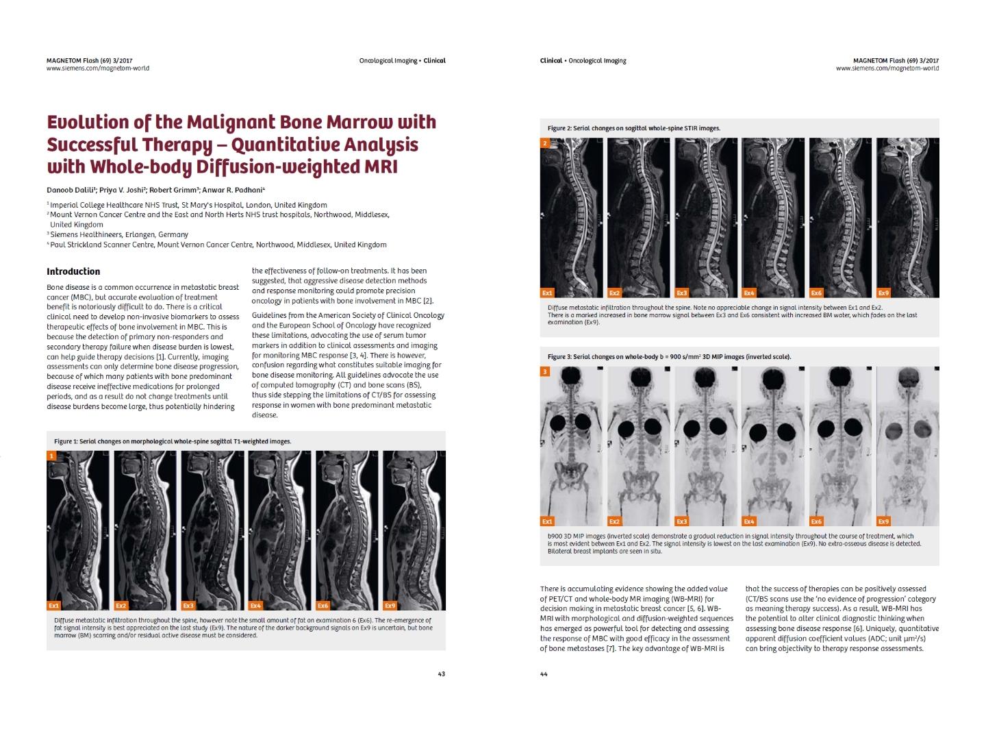 magnetom-flash-69_evolution-of-the-malignant-bone-marrow.jpg