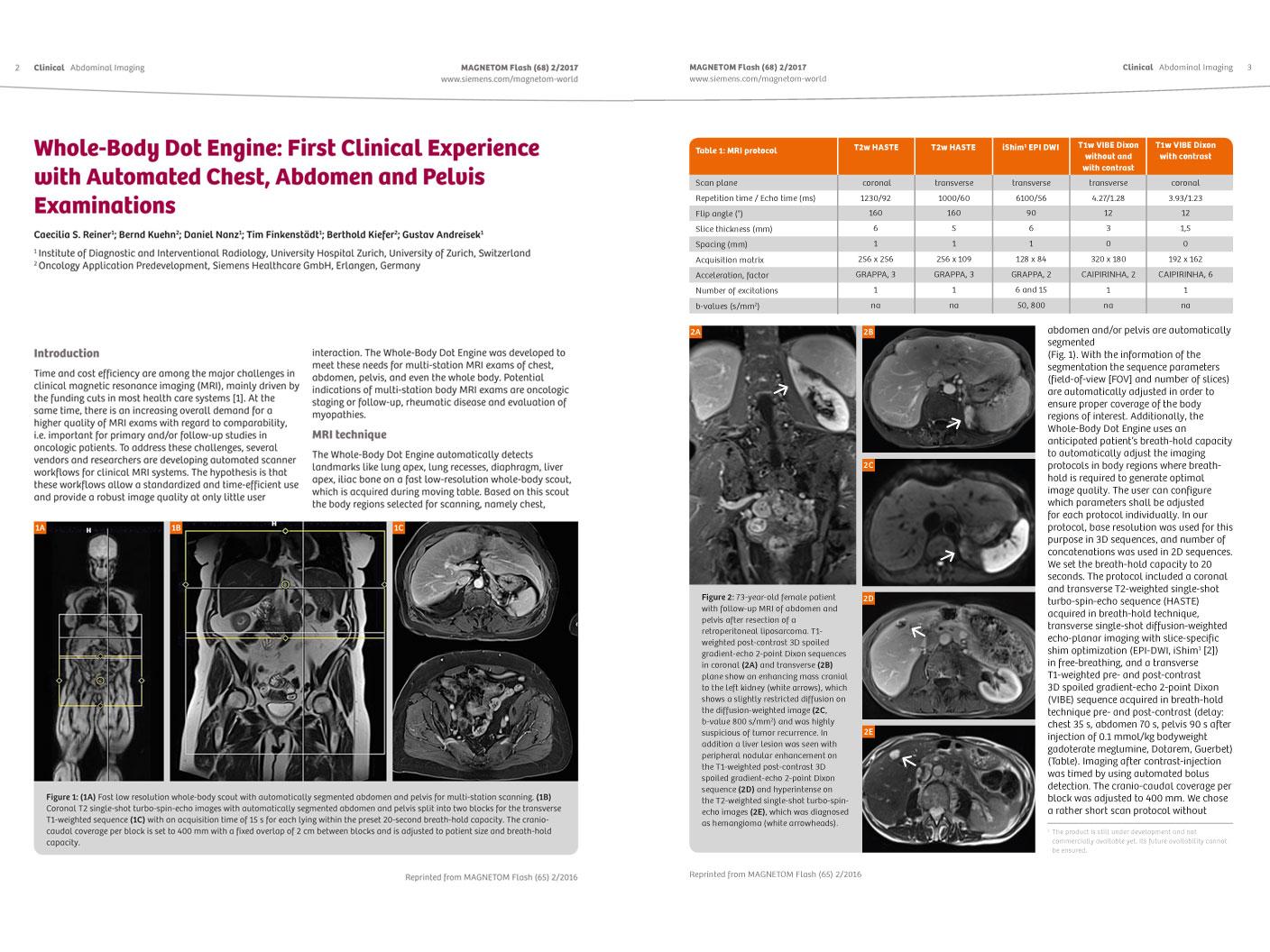 Siemens Healthineers - MRI - Dot at MAGNETOM World  - Reiner - Whole-Body Dot Engine