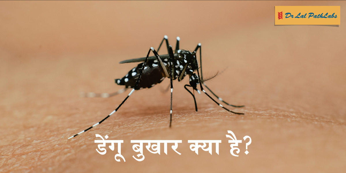 Dengue Fever (डेंगू बुखार) – कारण, लक्षण और इलाज 