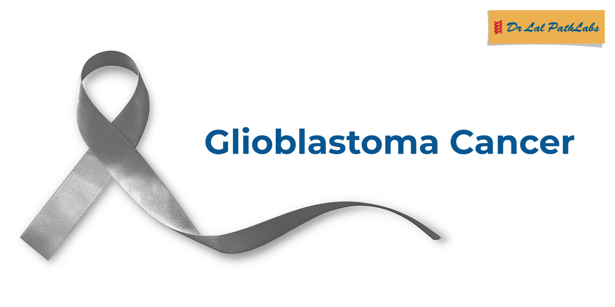 Glioblastoma Cancer: Symptoms, Causes & Diagnosis