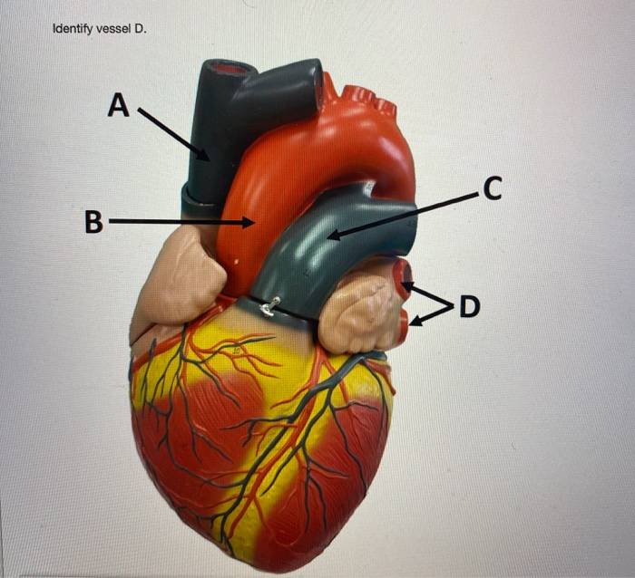 Solved Identify vessel C. A C B- QUESTION 27 Blood flows | Chegg.com