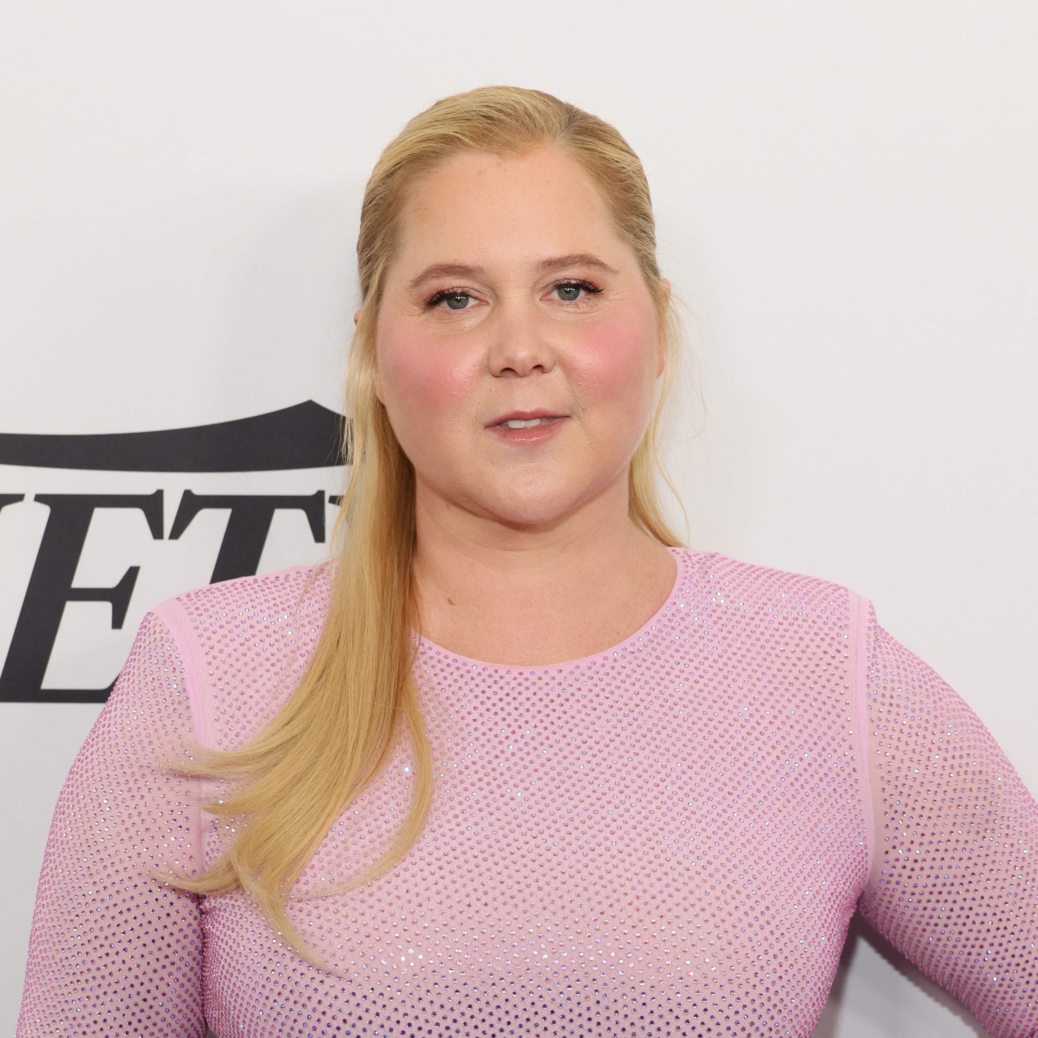 Amy Schumer Says Internet Trolls Diagnosed Her With Cushing Syndrome