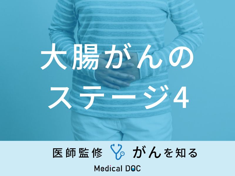 「大腸がん・ステージ4」の症状・余命はご存知ですか？医師が徹底解説！