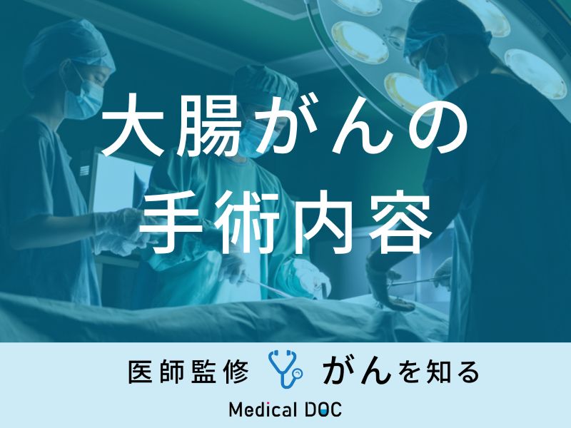 「大腸がんの手術内容」はご存知ですか？術後の合併症や入院期間も医師が解説！