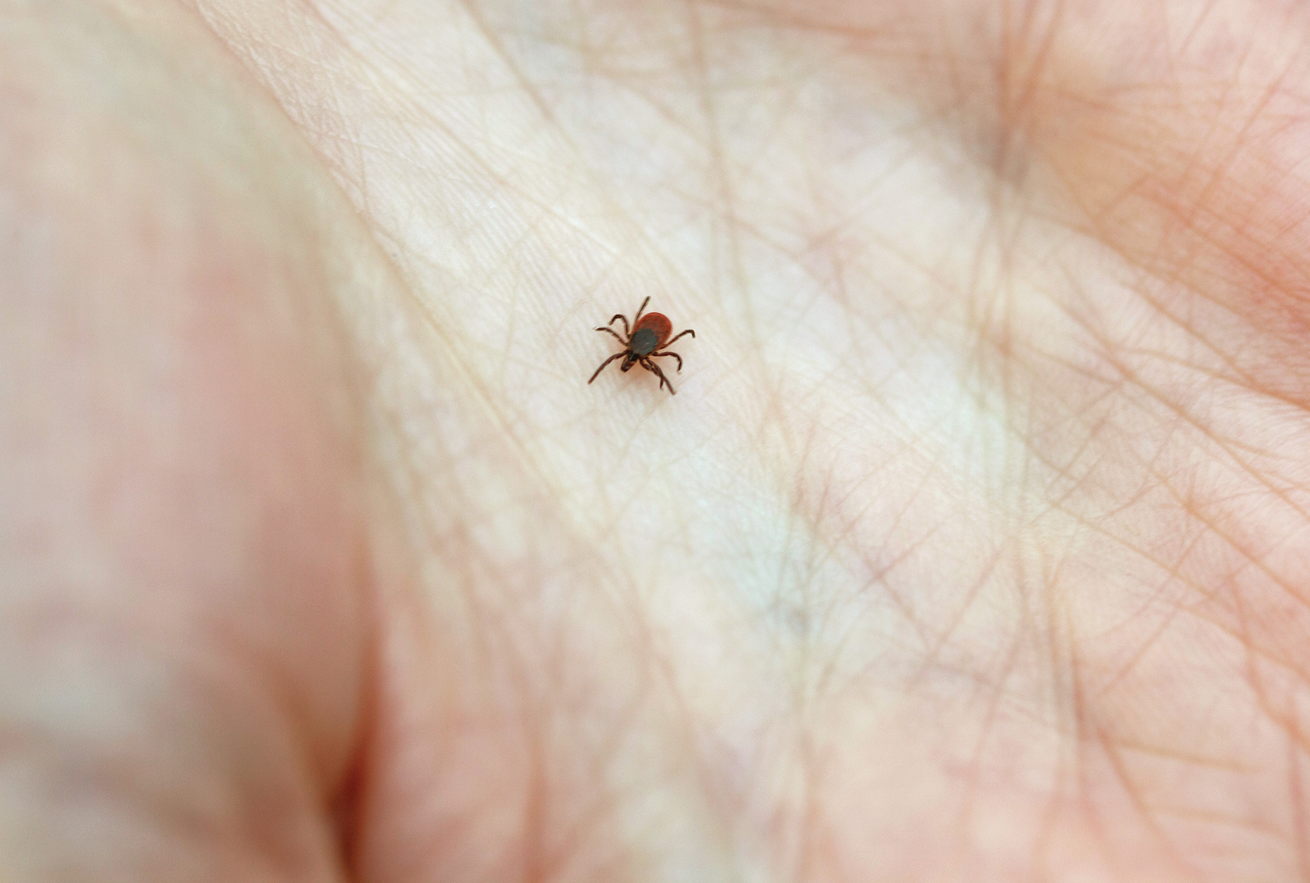 Normal Tick Bite Pictures