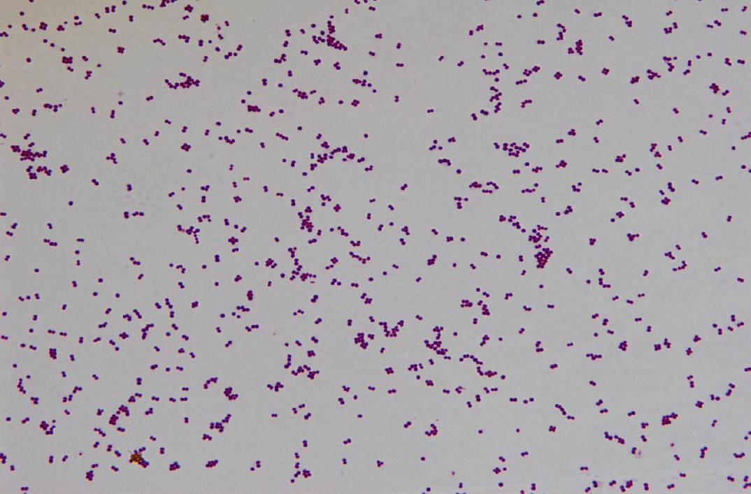 High quality draft genome sequence of Staphylococcus cohnii subsp ...