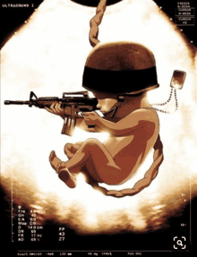 an ultrasound image of a baby in a helmet holding an assault rifle