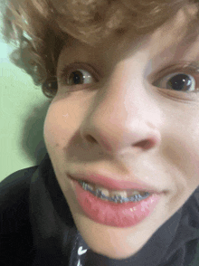 a close up of a person 's face with braces on