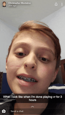 a young boy with braces on his teeth looks like he 's done playing virtual reality for three hours