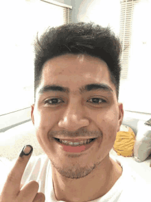 a man with braces on his teeth is smiling and showing his ink stained finger