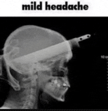 a black and white x-ray of a person 's head with a knife in it .