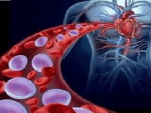 a computer generated image of a blood vessel with red blood cells and a heart in the background .