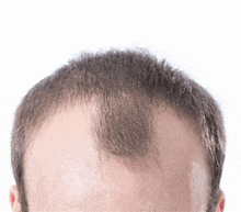 a close up of a man 's head with a very thin haircut .