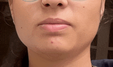 a close up of a woman 's face with a red spot on her chin