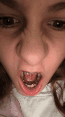 a close up of a girl 's mouth with braces on her teeth